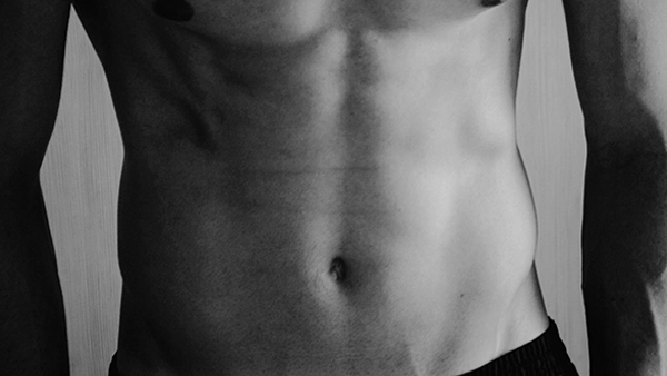 Abdominoplastia